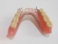 即日入れ歯|即日入れ歯グループ|アート歯科