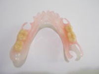 見た目を重視する方に 部分入れ歯|即日入れ歯グループ|アート歯科